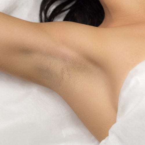 Laser-Haarentfernung Sugaring Waxing Zug Luzern Cham