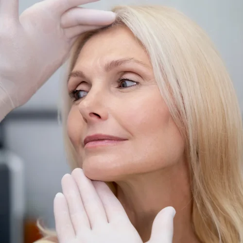 Microneedling für Anti Aging & Narben in Zug, Cham Luzern
